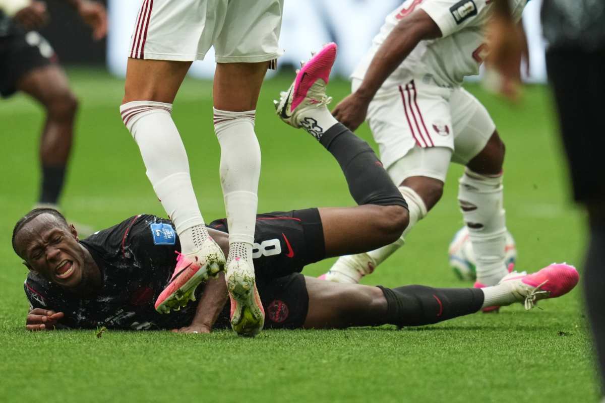 Ismael Kone gãy chân kinh hoàng tại World Cup 2026 1 Ismael Kone dính chấn thương gãy chân